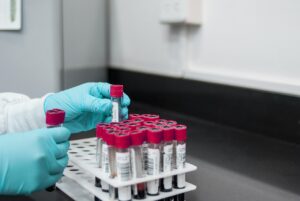 ワキガ手術の効果が無い理由とは？